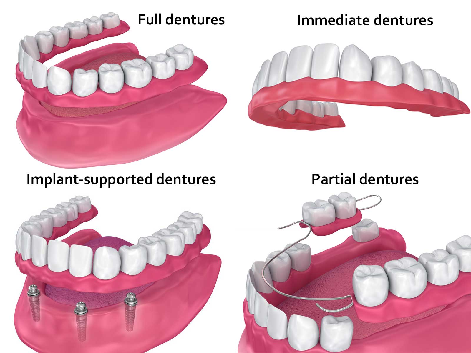 Dentures Overview